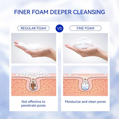 Vitamin C Facial Cleanser – Deep Cleansing Acne Care Face Wash