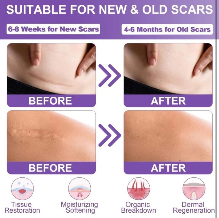 Scar Removal Patches – Smooth, Fade & Heal with Confidence