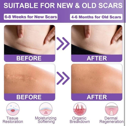 Scar Removal Patches – Smooth, Fade & Heal with Confidence
