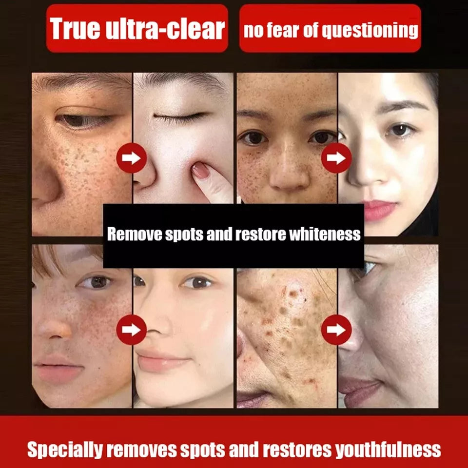 2025 New Anti-Blemish & Anti-Aging Tear-Off Mask (Clinically Certified)