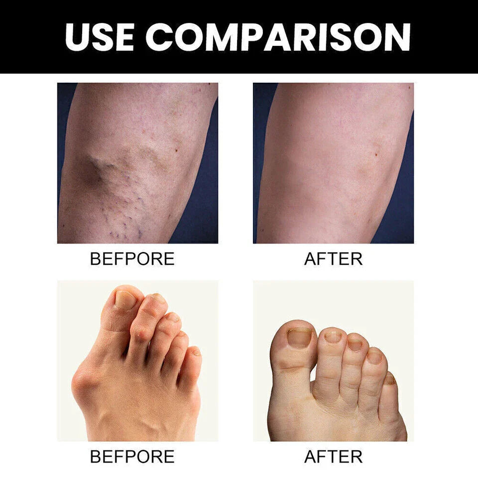 Perfectx Joint & Bone Therapy Cream