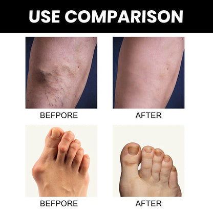 Perfectx Joint & Bone Therapy Cream