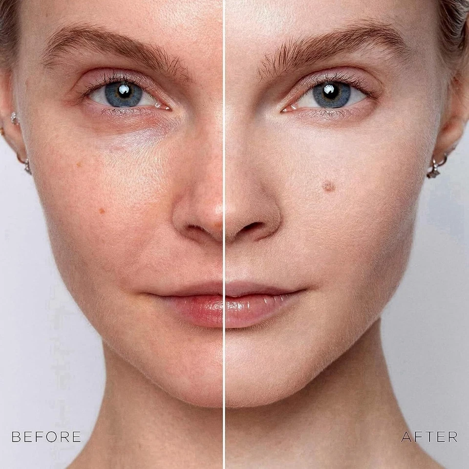 Dark Spot Corrector Serum – Advanced Brightening for Face & Body