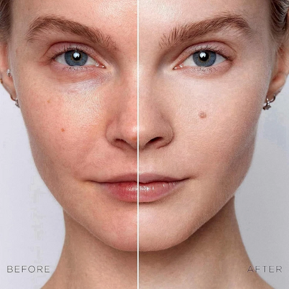Dark Spot Corrector Serum – Advanced Brightening for Face & Body