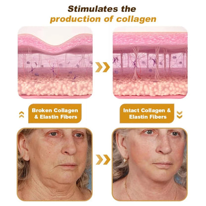 Bee Venom Wrinkle Cream – Smooth, Lift & Rejuvenate Naturally