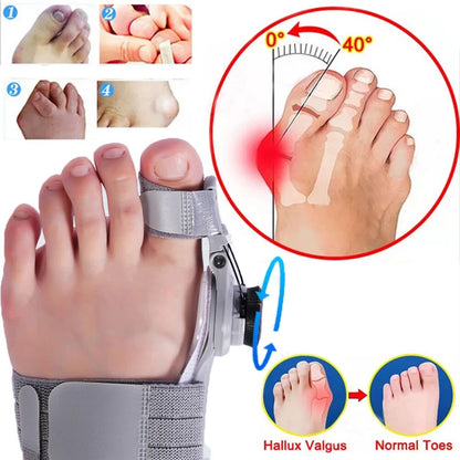 Bunion Fix Toe Valgus Corrector – Adjustable Orthosis Splint for Pain Relief & Alignment