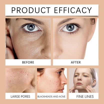 2025 New Anti-Blemish & Anti-Aging Tear-Off Mask (Clinically Certified)