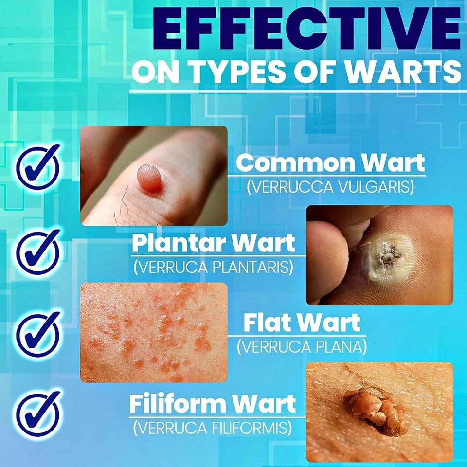 Skin Tag & Wart Remover Cream – Targeted Care for Smooth Skin