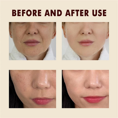 Rice Face Peel Shot – White & Black Rice Exfoliating Essence