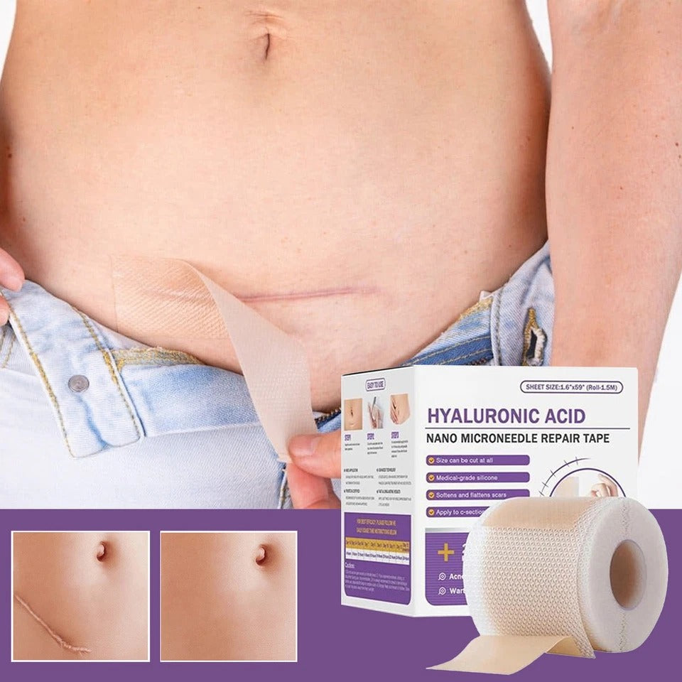 Scar Removal Patches – Smooth, Fade & Heal with Confidence