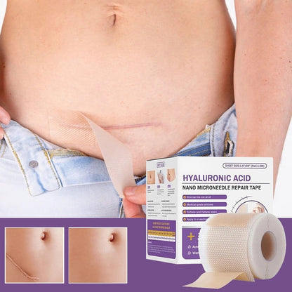 Scar Removal Patches – Smooth, Fade & Heal with Confidence