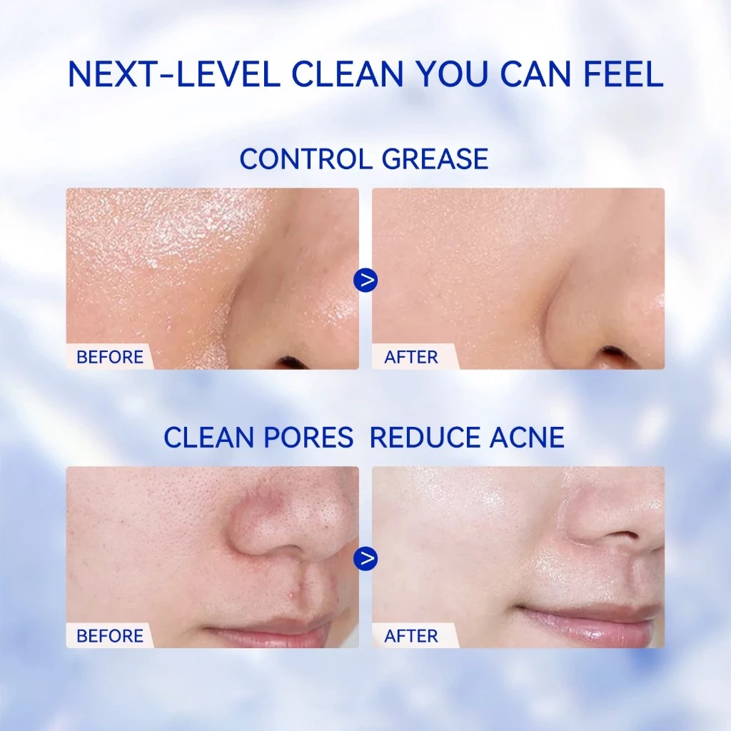 Vitamin C Facial Cleanser – Deep Cleansing Acne Care Face Wash
