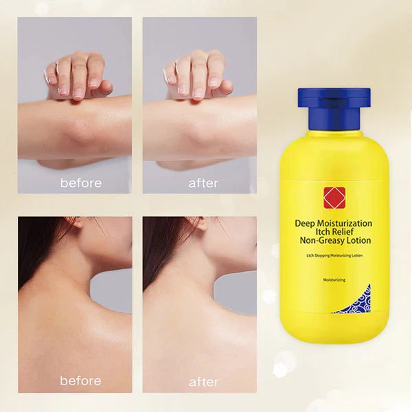 Non-greasy, anti-itch and deep moisturizing lotion
