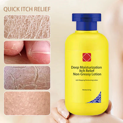 Non-greasy, anti-itch and deep moisturizing lotion