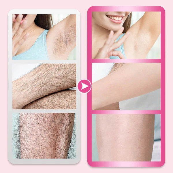 Gentle Hair Removal Cream – Smooth Skin Without the Pain