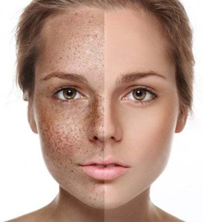 Anti-Wrinkle Moisturizing Peeling Mask