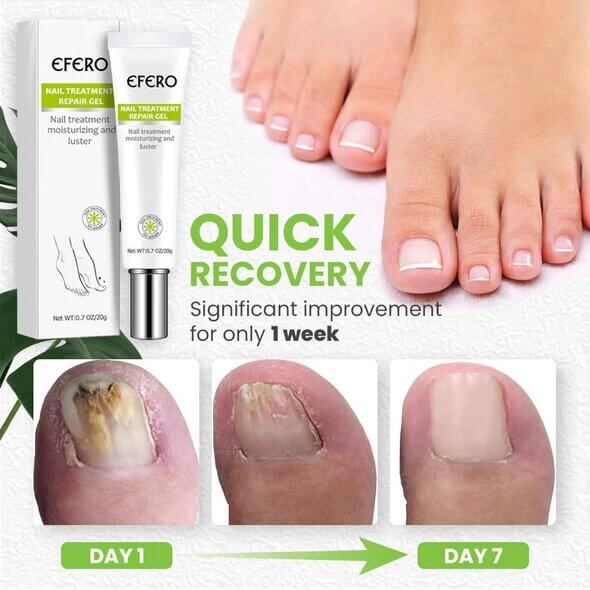Instant Nail Repair + Free Shipping AND Pay On delivery