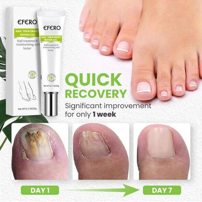 Instant Nail Repair + Free Shipping AND Pay On delivery
