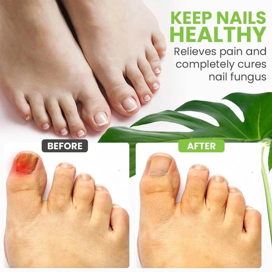 Instant Nail Repair + Free Shipping AND Pay On delivery