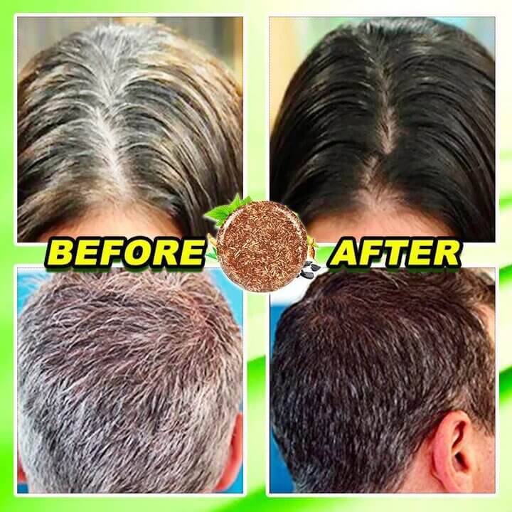 Hair Darkening Bar + Free Shipping AND Pay On delivery