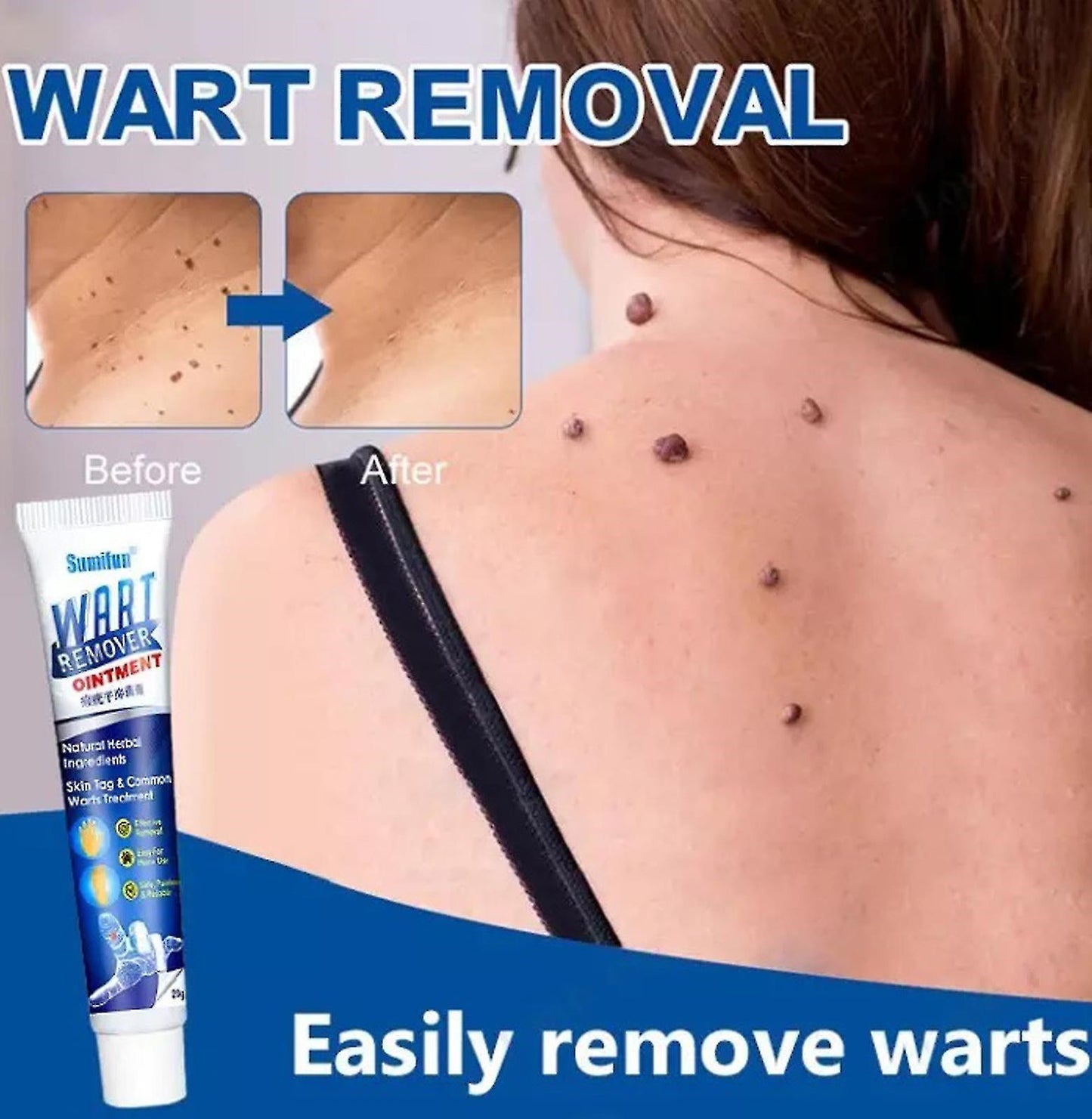 Wart Instant Blémish Cream