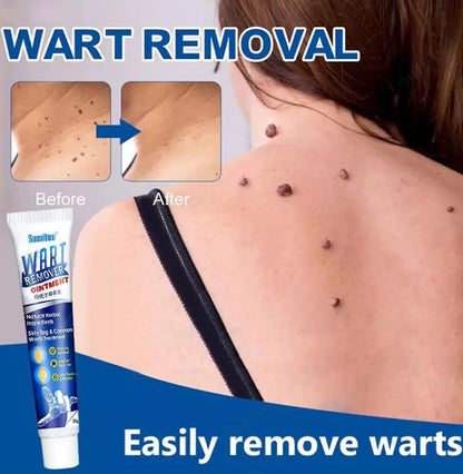 Wart Instant Blémish Cream