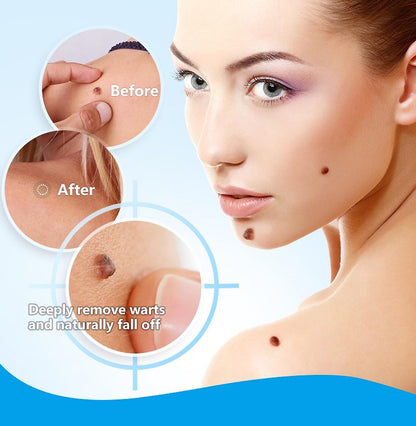 Wart Instant Blémish Cream