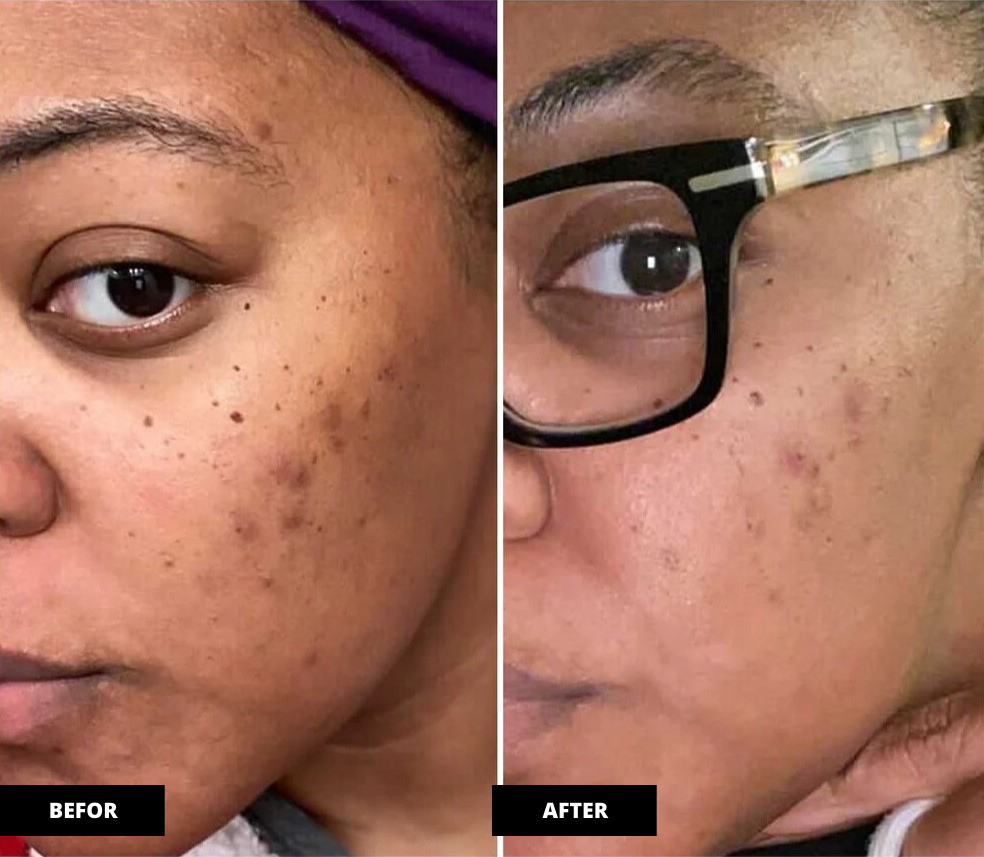Brightening Facial Serum