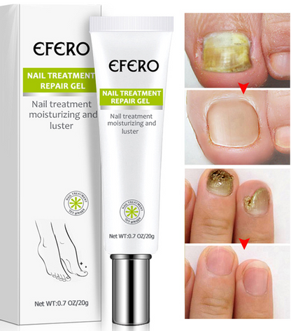 Instant Nail Repair + Free Shipping AND Pay On delivery