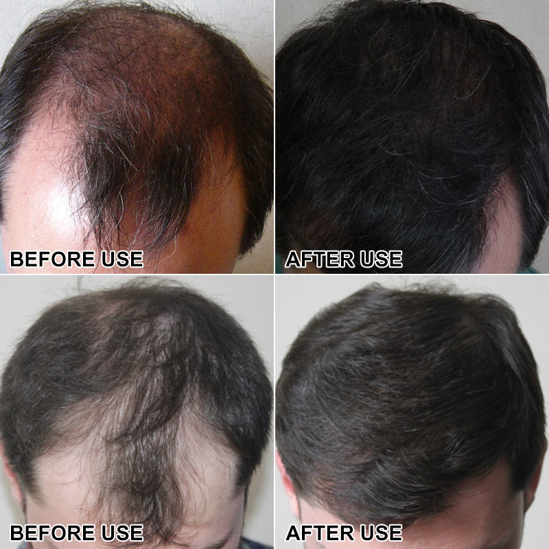 Secret Hair Fiber Powder