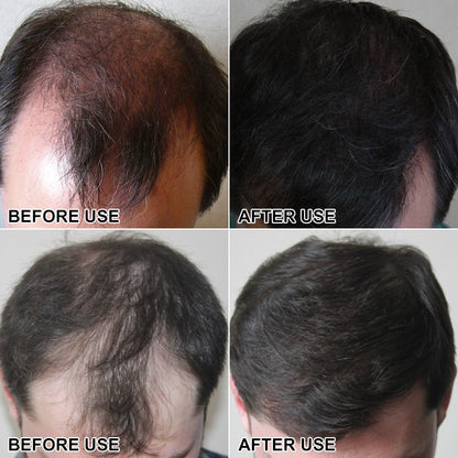 Secret Hair Fiber Powder