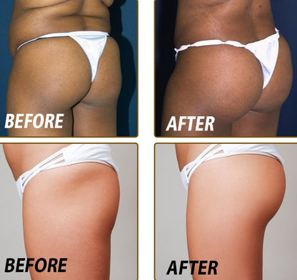 BunLift Buttocks Essential Oil