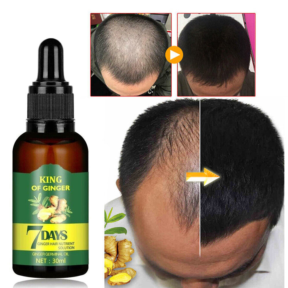 GINGER HAIR GROWTH